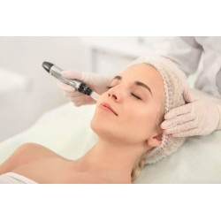 MICRONEEDLING FACIAL